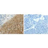 SLC16A1 Antibody from Signalway Antibody (31233) - Antibodies.com