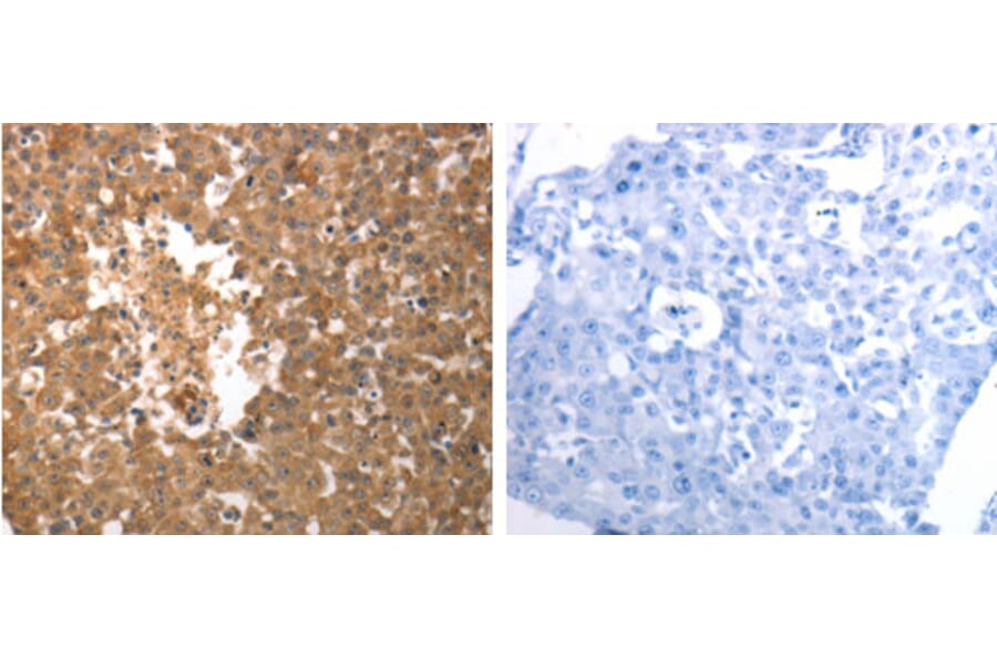 SLC22A6 Antibody from Signalway Antibody (31285) - Antibodies.com