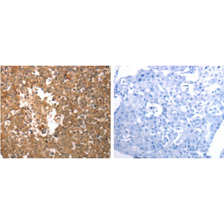 SLC22A6 Antibody from Signalway Antibody (31285) - Antibodies.com