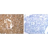 SLC22A6 Antibody from Signalway Antibody (31285) - Antibodies.com