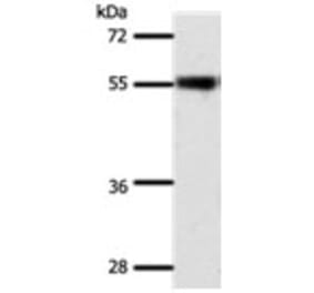 SLC32A1 Antibody from Signalway Antibody (31292) - Antibodies.com
