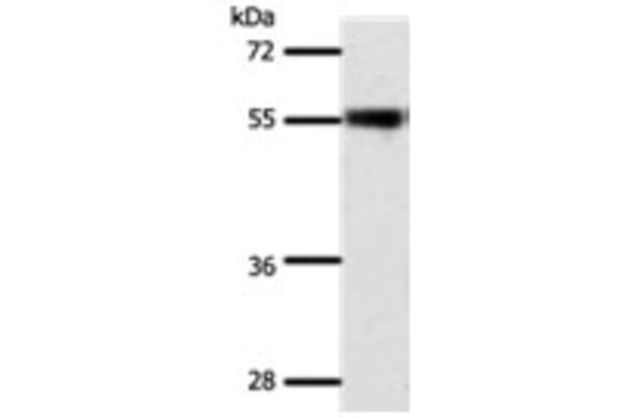 SLC32A1 Antibody from Signalway Antibody (31292) - Antibodies.com