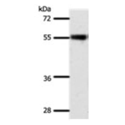 SLC32A1 Antibody from Signalway Antibody (31292) - Antibodies.com