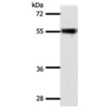 SLC32A1 Antibody from Signalway Antibody (31292) - Antibodies.com