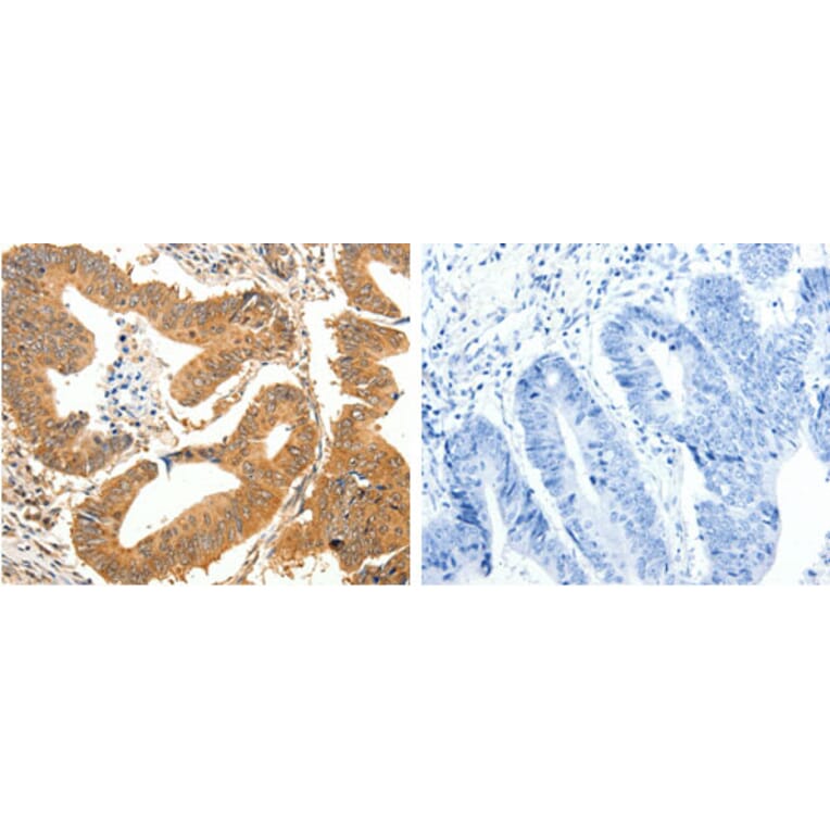SLC32A1 Antibody from Signalway Antibody (31292) - Antibodies.com