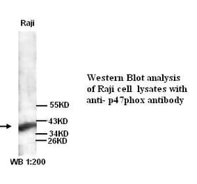 p47phox Antibody from Signalway Antibody (39260) - Antibodies.com