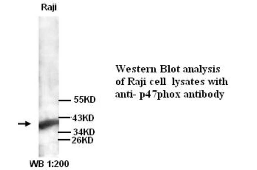 p47phox Antibody from Signalway Antibody (39260) - Antibodies.com