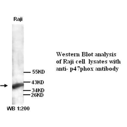p47phox Antibody from Signalway Antibody (39260) - Antibodies.com