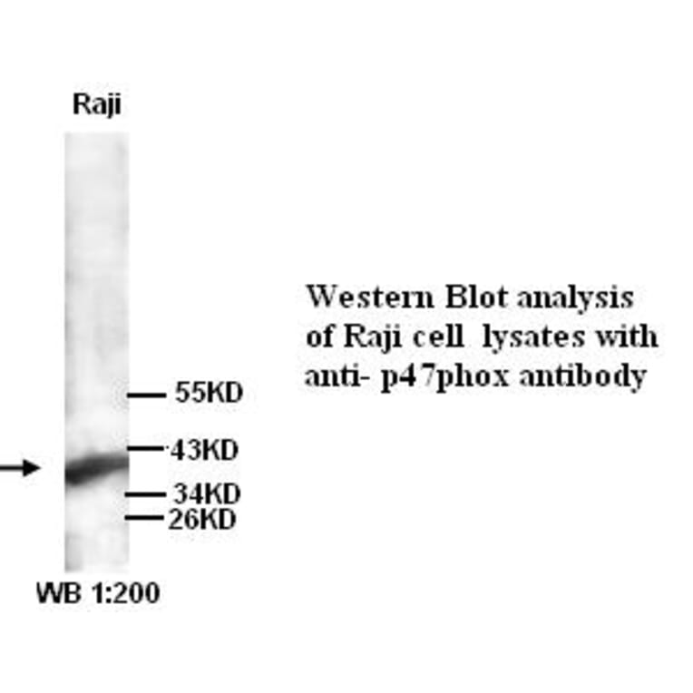 p47phox Antibody from Signalway Antibody (39260) - Antibodies.com