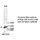 p47phox Antibody from Signalway Antibody (39260) - Antibodies.com