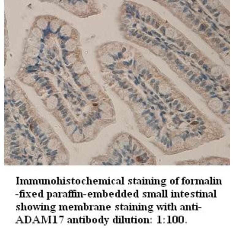 ADAM-17 Antibody from Signalway Antibody (39313) - Antibodies.com