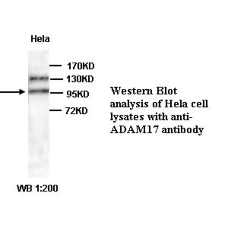 ADAM-17 Antibody from Signalway Antibody (39313) - Antibodies.com