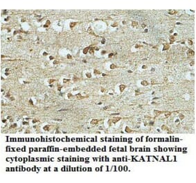 KATNAL1 Antibody from Signalway Antibody (39702) - Antibodies.com
