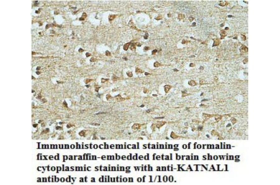 KATNAL1 Antibody from Signalway Antibody (39702) - Antibodies.com
