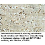 KATNAL1 Antibody from Signalway Antibody (39702) - Antibodies.com