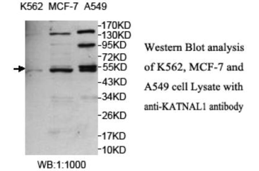 KATNAL1 Antibody from Signalway Antibody (39702) - Antibodies.com