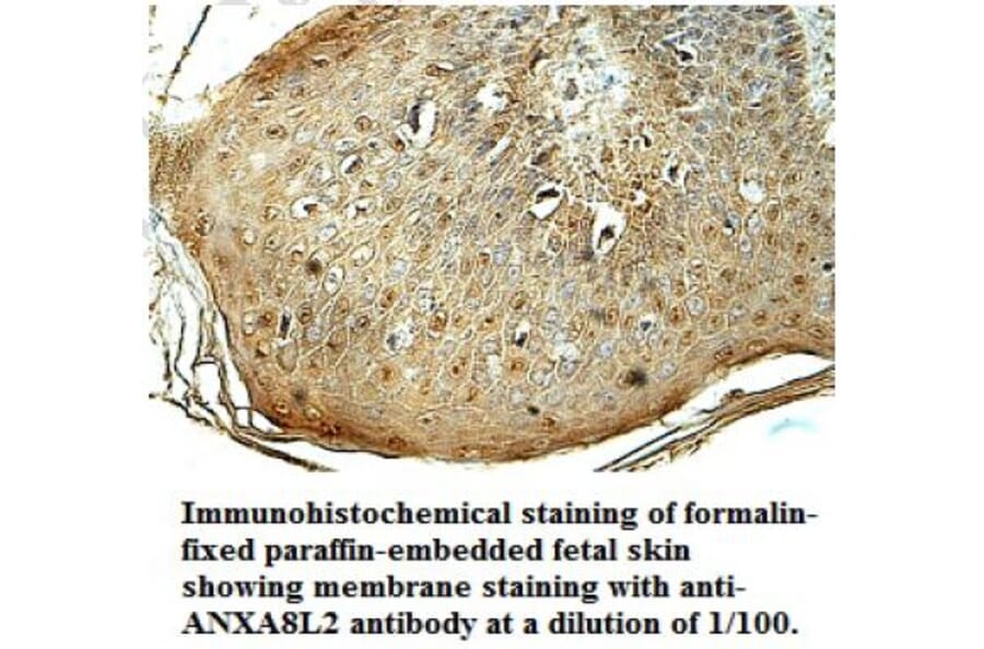 ANXA8L2 Antibody from Signalway Antibody (39703) - Antibodies.com