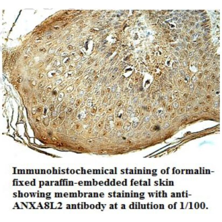 ANXA8L2 Antibody from Signalway Antibody (39703) - Antibodies.com