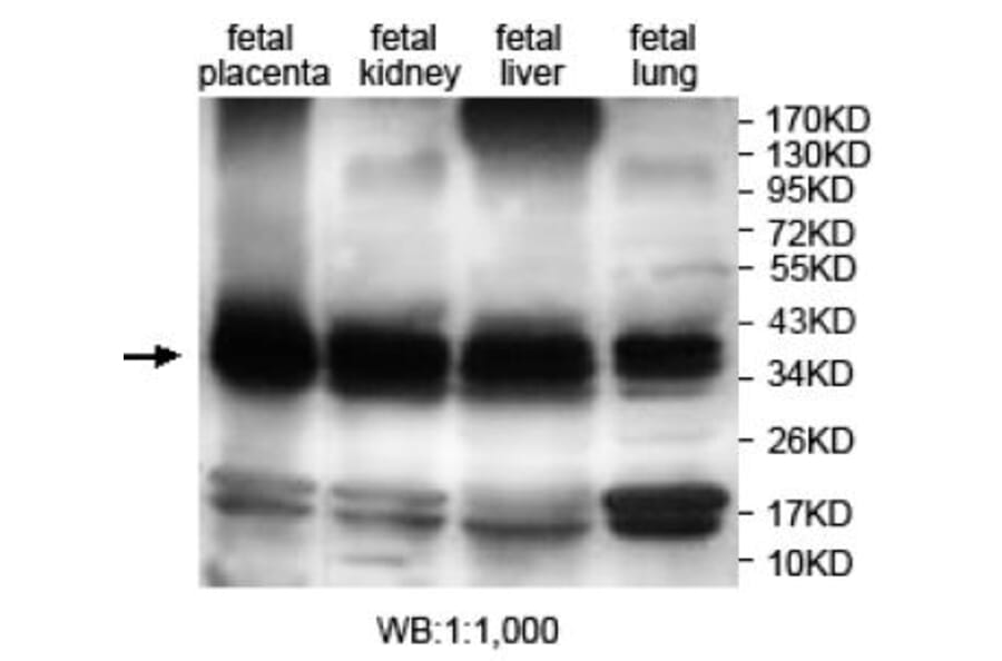ANXA8L2 Antibody from Signalway Antibody (39703) - Antibodies.com