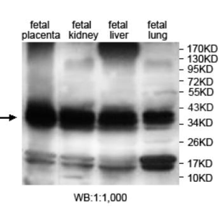 ANXA8L2 Antibody from Signalway Antibody (39703) - Antibodies.com