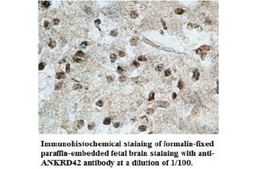 ANKRD42 Antibody from Signalway Antibody (39708) - Antibodies.com