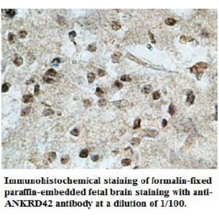 ANKRD42 Antibody from Signalway Antibody (39708) - Antibodies.com