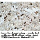 ANKRD42 Antibody from Signalway Antibody (39708) - Antibodies.com