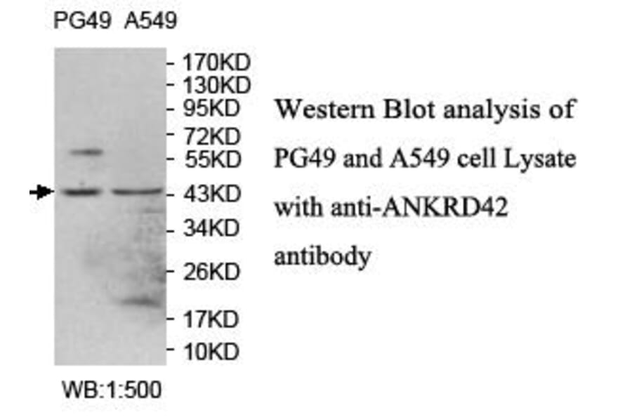 ANKRD42 Antibody from Signalway Antibody (39708) - Antibodies.com