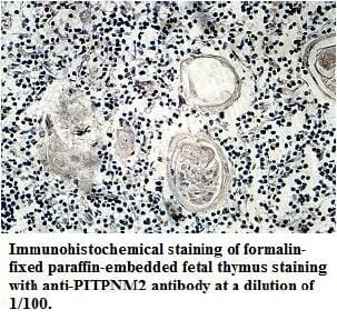 Anti-PITPNM2 Antibody