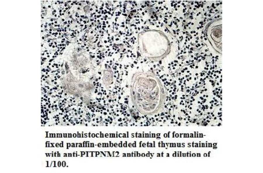 PITPNM2 Antibody from Signalway Antibody (39711) - Antibodies.com