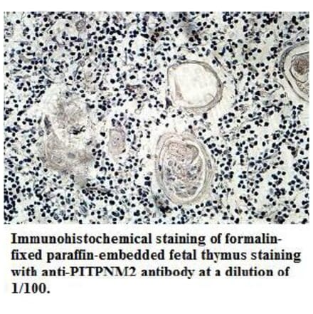 PITPNM2 Antibody from Signalway Antibody (39711) - Antibodies.com