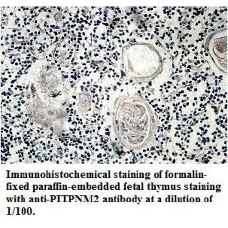 PITPNM2 Antibody from Signalway Antibody (39711) - Antibodies.com