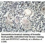 PITPNM2 Antibody from Signalway Antibody (39711) - Antibodies.com