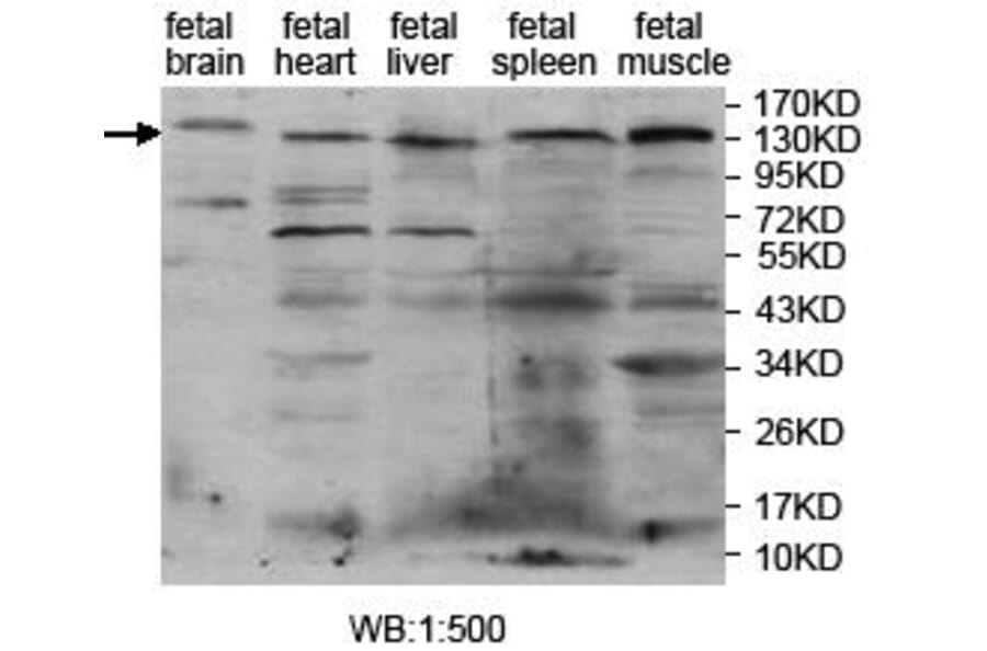 PITPNM2 Antibody from Signalway Antibody (39711) - Antibodies.com