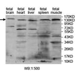 PITPNM2 Antibody from Signalway Antibody (39711) - Antibodies.com