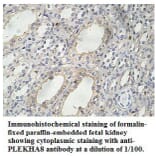 PLEKHA8 Antibody from Signalway Antibody (39767) - Antibodies.com