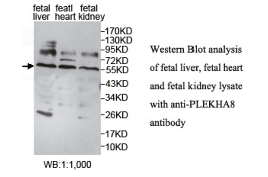 PLEKHA8 Antibody from Signalway Antibody (39767) - Antibodies.com