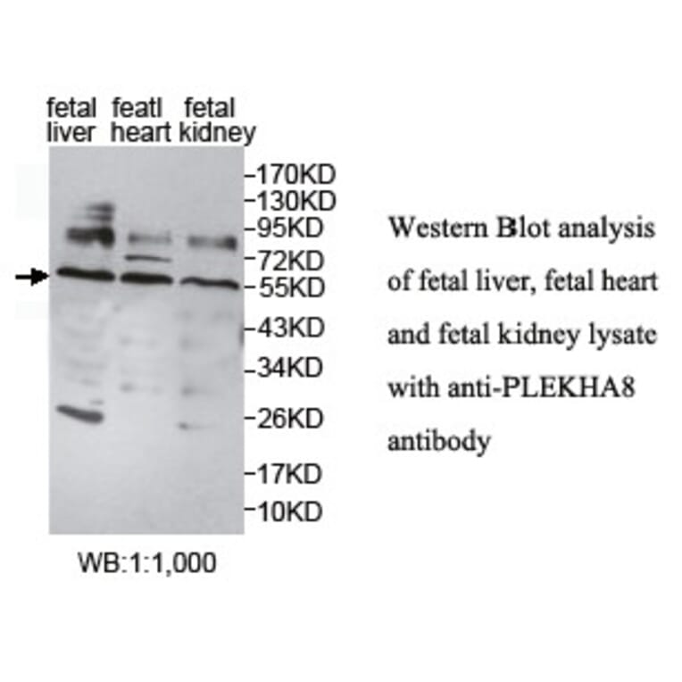 PLEKHA8 Antibody from Signalway Antibody (39767) - Antibodies.com