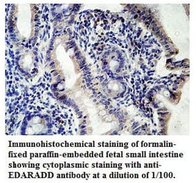 EDARADD Antibody from Signalway Antibody (39769) - Antibodies.com