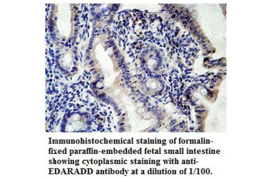 EDARADD Antibody from Signalway Antibody (39769) - Antibodies.com