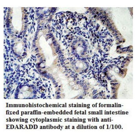 EDARADD Antibody from Signalway Antibody (39769) - Antibodies.com