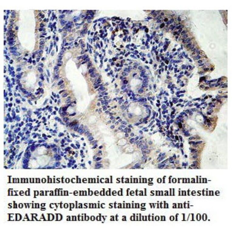 EDARADD Antibody from Signalway Antibody (39769) - Antibodies.com