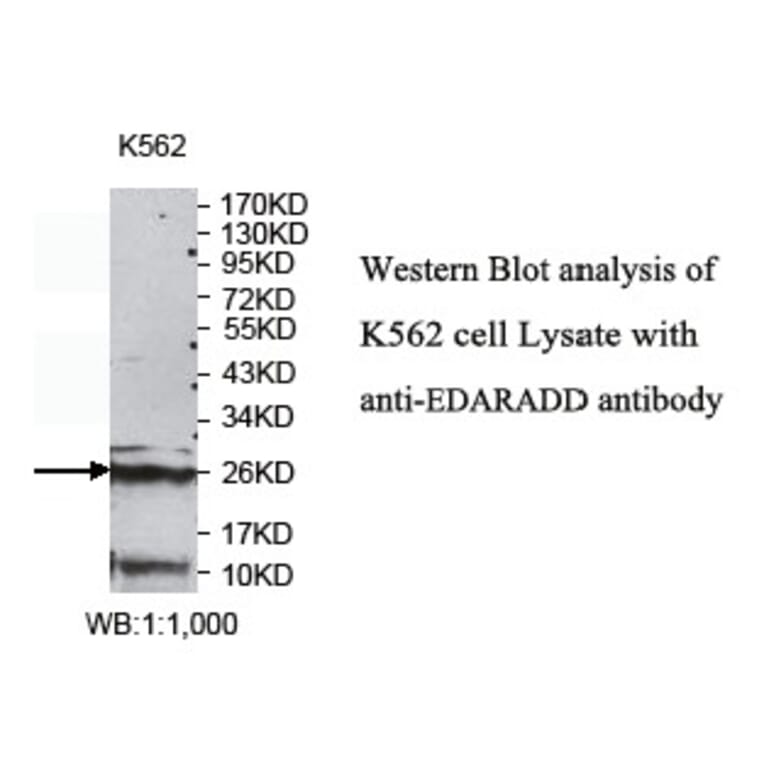 EDARADD Antibody from Signalway Antibody (39769) - Antibodies.com