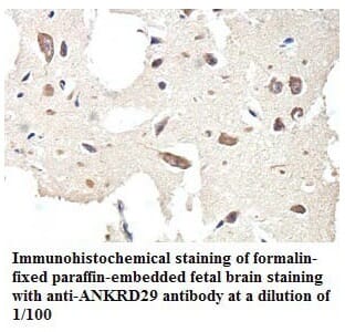 Anti-ANKRD29 Antibody
