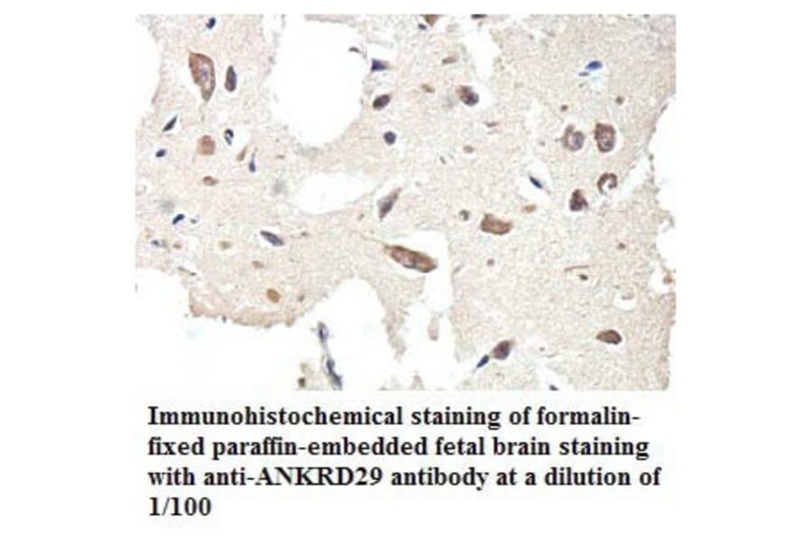 ANKRD29 Antibody from Signalway Antibody (39772) - Antibodies.com