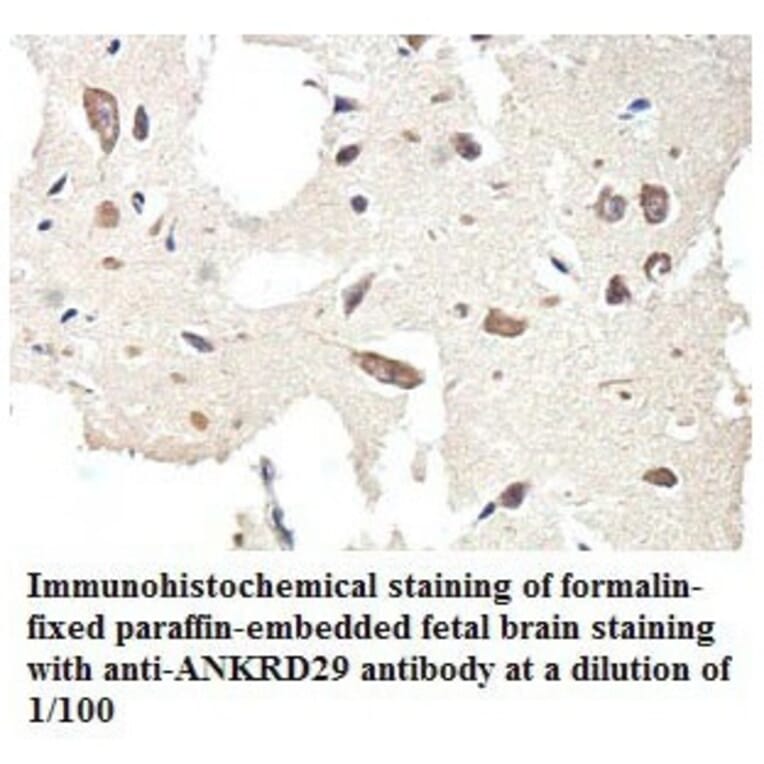 ANKRD29 Antibody from Signalway Antibody (39772) - Antibodies.com
