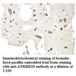 ANKRD29 Antibody from Signalway Antibody (39772) - Antibodies.com