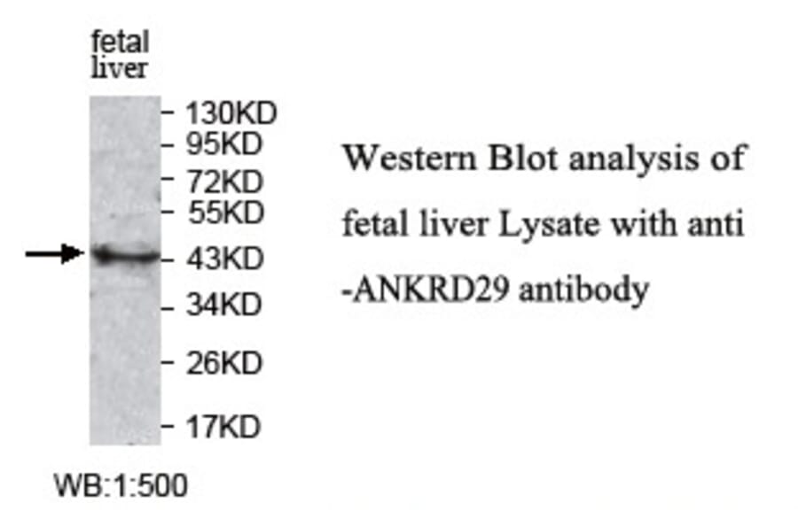 ANKRD29 Antibody from Signalway Antibody (39772) - Antibodies.com