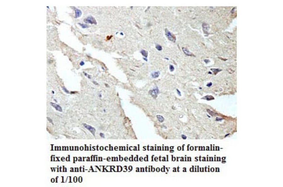 ANKRD39 Antibody from Signalway Antibody (39773) - Antibodies.com