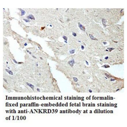 ANKRD39 Antibody from Signalway Antibody (39773) - Antibodies.com
